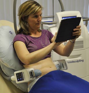 coolsculpting experience in the clinic