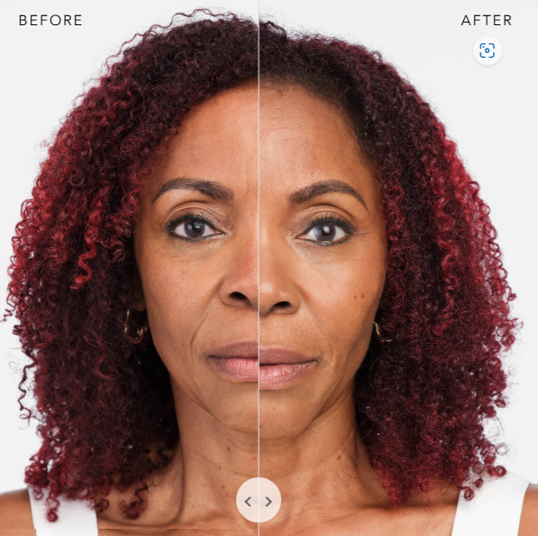 BEFORE AND AFTER 2