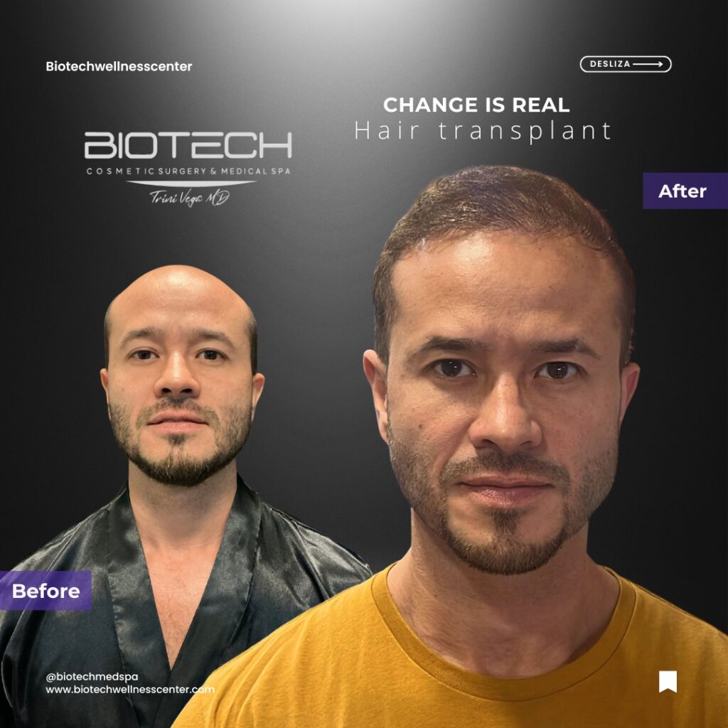 Beige Minimalist Before After Hair Salon Instagram Post (7)