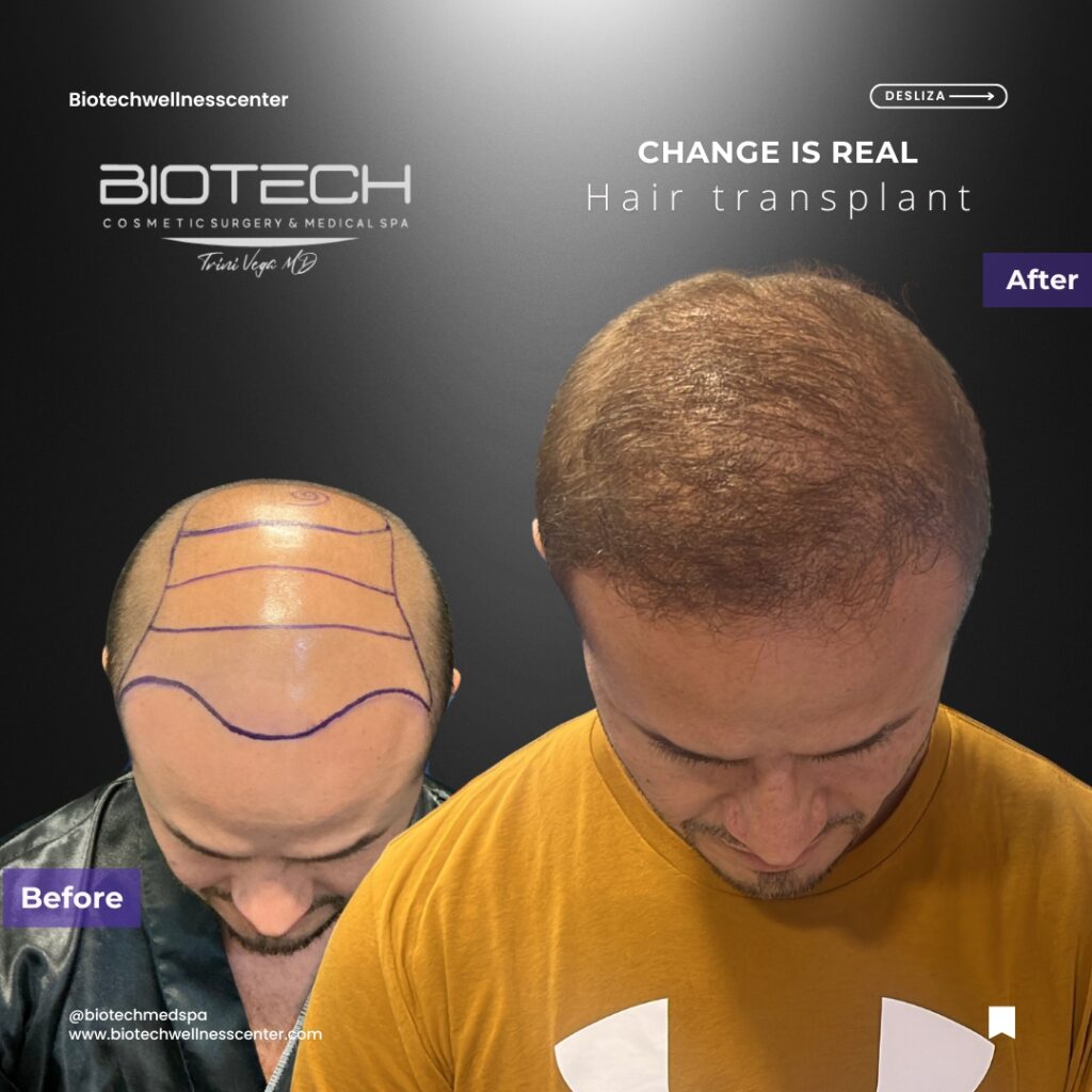 Beige Minimalist Before After Hair Salon Instagram Post (9)